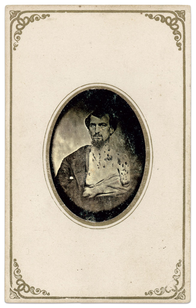 Tintype in carte de visite envelope by an unidentified photographer. Author's collection.