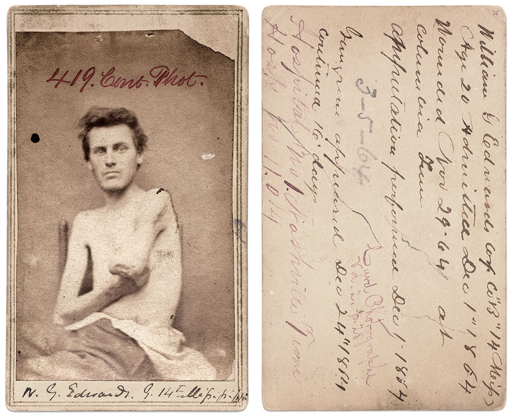 Carte de visite by an unidentified photographer connected to Hospital No. 1 in Nashville, Tenn. 