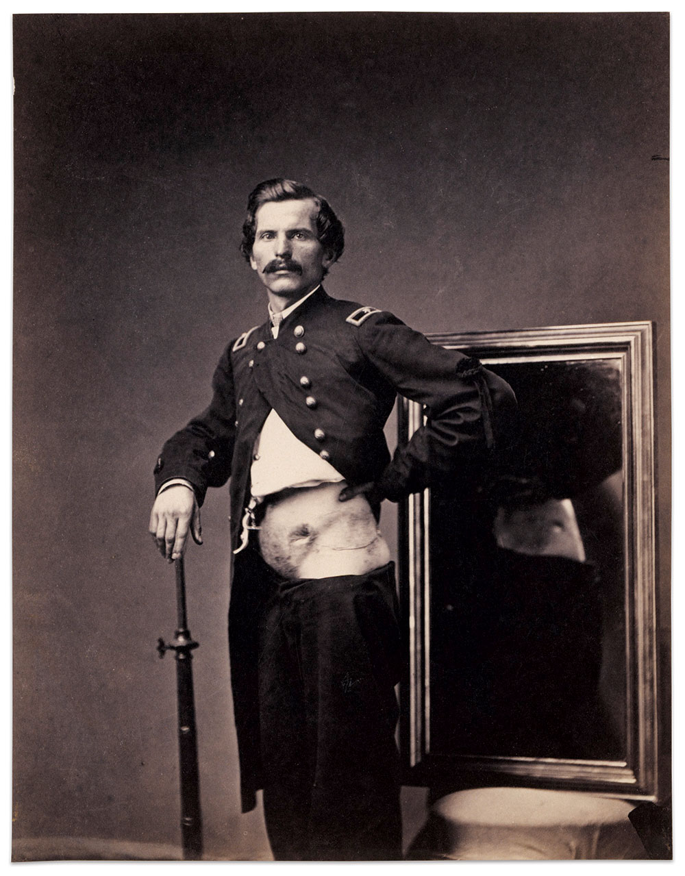 This often reproduced portrait of Barnum documents the successful surgery for the debilitating abdominal wound received at Malvern Hill. Albumen print by William Bell for the U.S. Army Medical Department. Smithsonian American Art Museum.