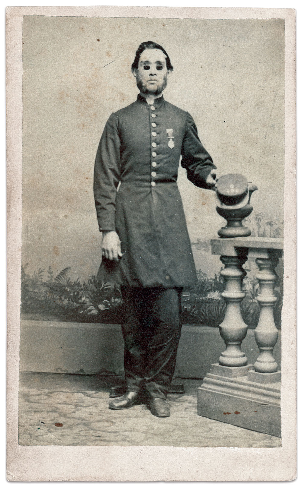 Private David Henry Wintress (1844-1908), 139th New York Infantry, circa 1866. He suffered a gunshot wound in the April 12, 1863, Battle of Williamsburg, Va., that took both eyes. Carte de visite by an unidentified photographer. 
