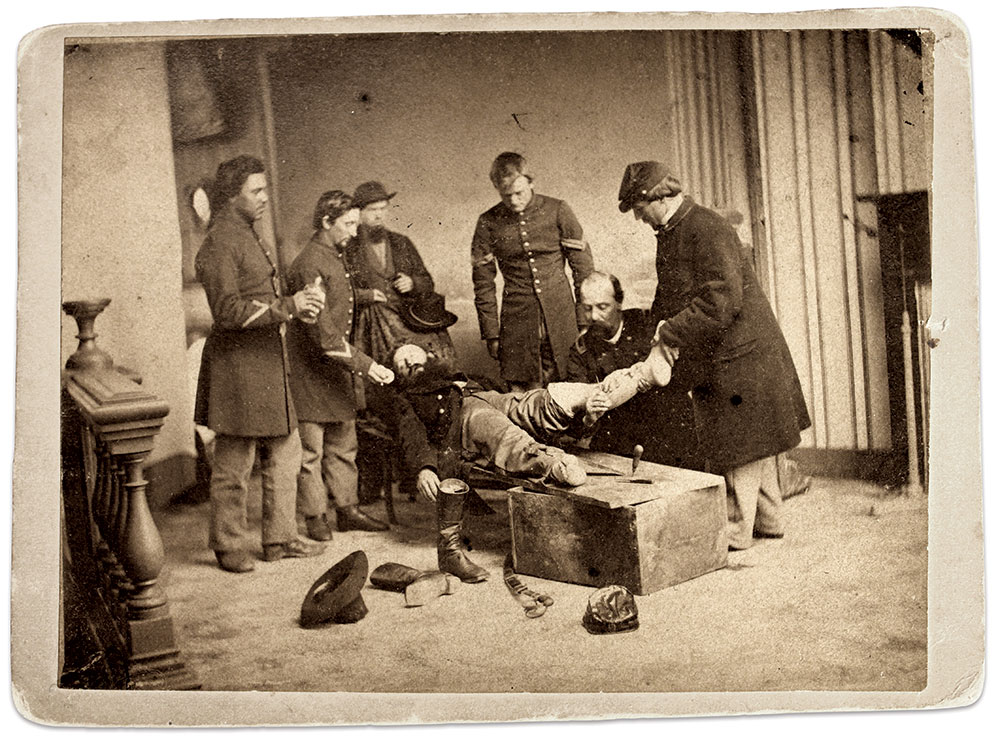Tableau of a surgical amputation: The way the individuals are posed indicates they have had experience in such operations. The surgeon leans into his patient, a Union officer lying on a makeshift table, pressing his scalpel against the leg just below the knee. An assistant stabilizes the patient’s lower leg. Two more assistants, wearing thick chevrons on their sleeves, administer an anesthetic, likely chloroform or ether. A corporal and an enlisted man observe the procedure. The officer’s boots, sword and cap, and the surgeon’s hat and implements, are artfully arranged around the patient. Albumen print by an unidentified photographer. Buck Zaidel Collection.