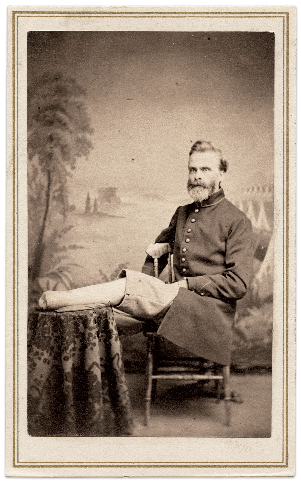 Documenting “morbid anatomy” cases: Photographs such as this were made at the request of surgeons directed by the U.S. Army Medical Museum beginning in 1862. Carte de visite by R. Loeb, Emory Hospital, Washington D.C. Kevin Canberg Collection.