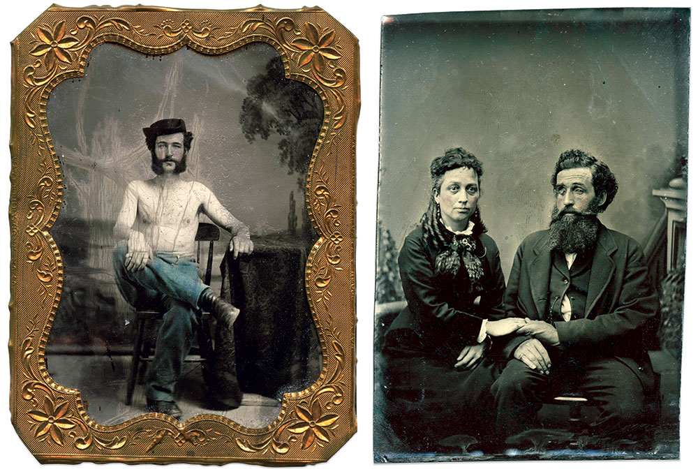Berry is pictured during the war, shirtless and with both eyes intact, and with his wife, Maria Litchfield, about the time of their marriage in 1878. Sixth- and eighth-plate tintypes by unidentified photographers. Paul Russinoff Collection.